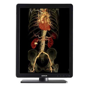 Barco MDNC-3421 K9300340A Radiology Monitor