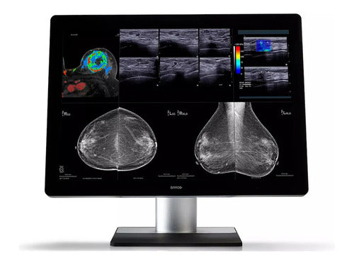 Monitors>Medical Grade Monitors - Barco - K9610592B - New
