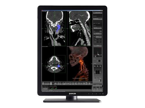 Monitors>Medical Grade Monitors - Barco - K9602994 - New