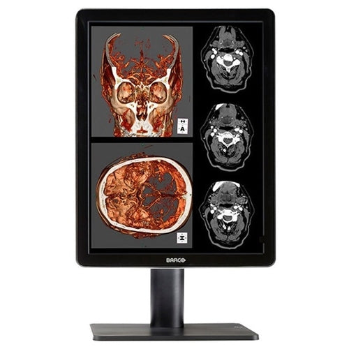 Monitors>Medical Grade Monitors - Barco - K9601789 - New